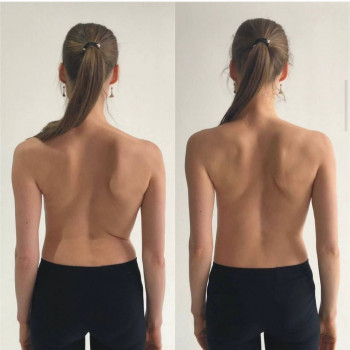 Курс Лікувального масажу
                    Массажный салон MD PRO Киев