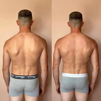 Курс Лікувального масажу
                    Массажный салон MD PRO Киев