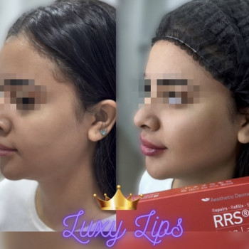 Алёна Слободенюк, Одесса Фото - 6