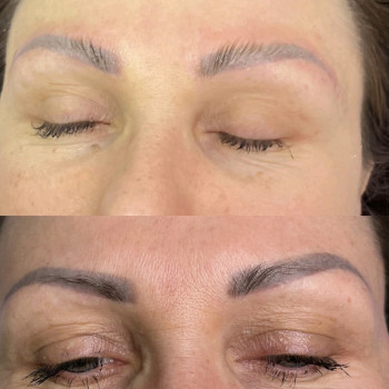 Видалення татуажу, перманенту лазер/ремувер
                    Мастер перманентного макияжа Тетяна Киев