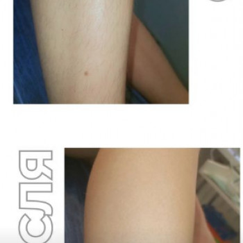 Hair Away, Киев Фото - 5