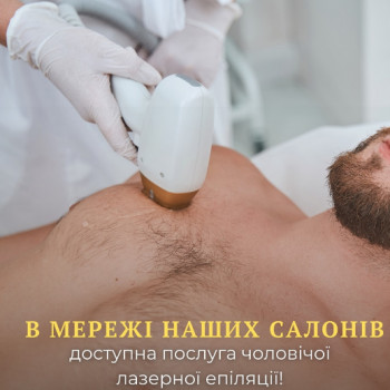 лазерная эпиляция
