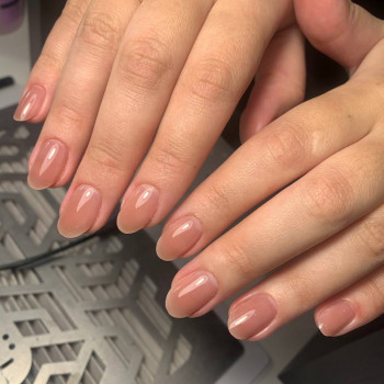 фото після процедури