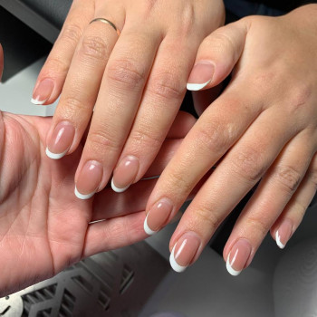 фото до процедури