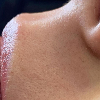 Яся Мілетська, Київ Фото - 5