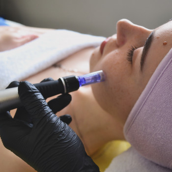 Фракційна мезотерапія. Мікронідлинг.