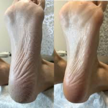 Комплекс для ніг
                    Мастер маникюра Alina Днепр