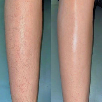 Депіляція
                    Мастер маникюра Юлія Белая Церковь