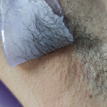 Ваксінг підпашки час проведення від 5-10 хв