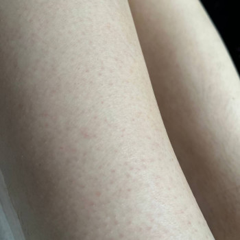 Ирина Михалевич, Одесса Фото - 15