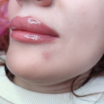 Катерина Кібець, Чернівці Фото - 12