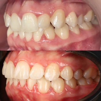 Лілія Білинець, Ужгород Фото - 1