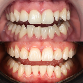 Лілія Білинець, Ужгород Фото - 3