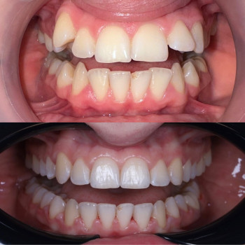 Лілія Білинець, Ужгород Фото - 4