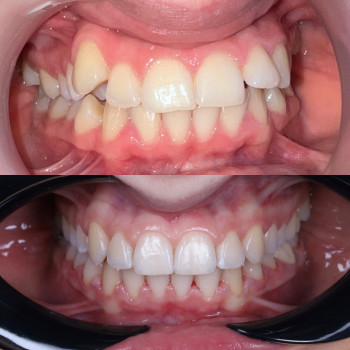 Лілія Білинець, Ужгород Фото - 5