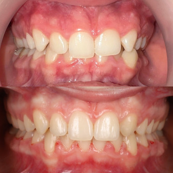 Лілія Білинець, Ужгород Фото - 6