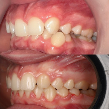 Лілія Білинець, Ужгород Фото - 7