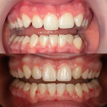 Лілія Білинець, Ужгород Фото - 8