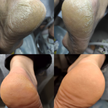 Тетяна Головко, Борисполь Фото - 5