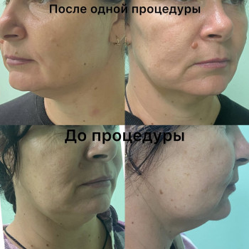 Ліполітики
                    Майстер епіляції Янітта Київ