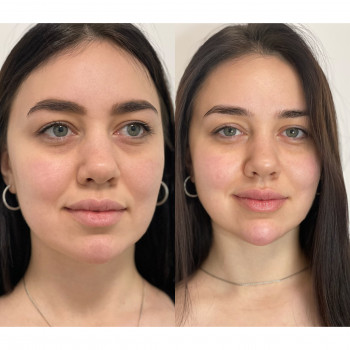 Зоряна Штипка, Львів Фото - 6