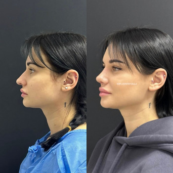 Абдель Эрритали, Київ Фото - 24