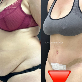 Абдель Эрритали, Київ Фото - 30