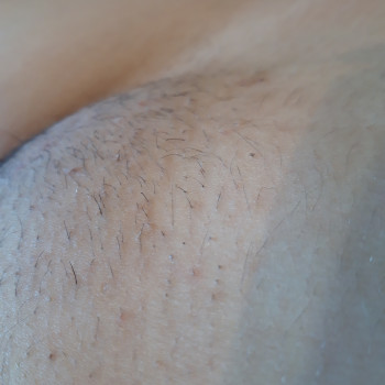 Відростання 2 тижні бікіні