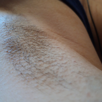 Відростання 3 тижні пахви