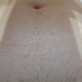 Живіт після бритви