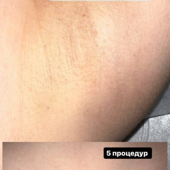 Анна Щербина, Днепрорудное Фото - 5