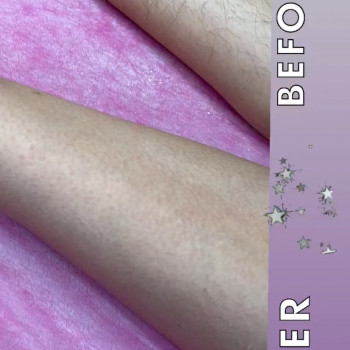 Ніжки (до/після)