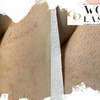 Wow Laser, Київ Фото - 5