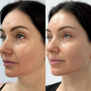 Tetiana Zolotko, Київ Фото - 6