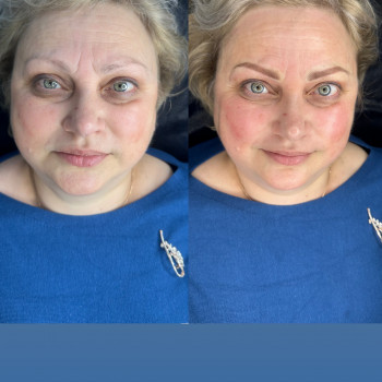 Людмила Сыч, Бровары Фото - 6