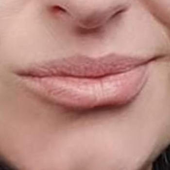 До процедуры пм