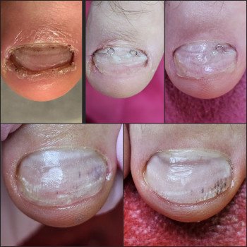 Корекційні системи
                    Подолог Ольга Бровары