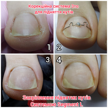 Корекційні системи
                    Подолог Ольга Бровары