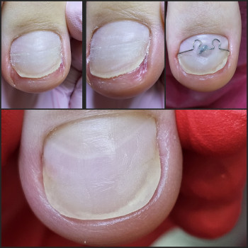 Корекційні системи
                    Подолог Ольга Бровары