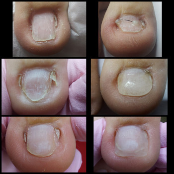 Корекційні системи
                    Подолог Ольга Бровары