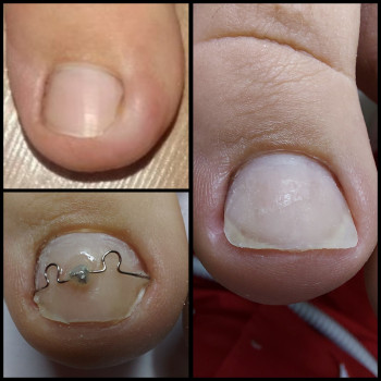 Корекційні системи
                    Подолог Ольга Бровары