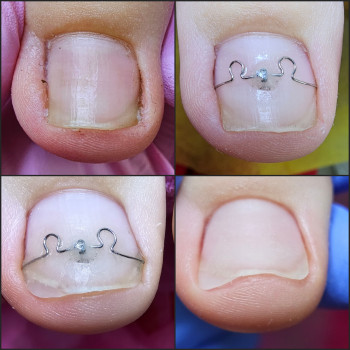 Корекційні системи
                    Подолог Ольга Бровары