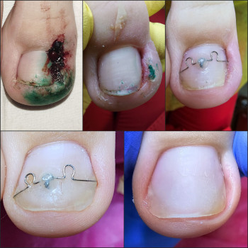 Корекційні системи
                    Подолог Ольга Бровары