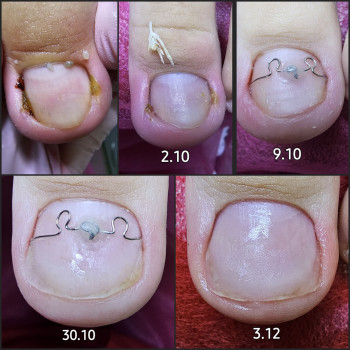 Корекційні системи
                    Подолог Ольга Бровары