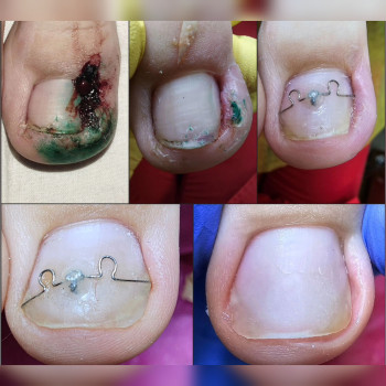 Корекційні системи
                    Подолог Ольга Бровары