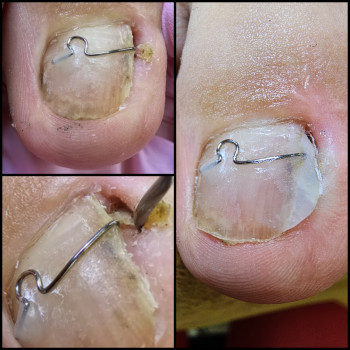 Корекційні системи
                    Подолог Ольга Бровары