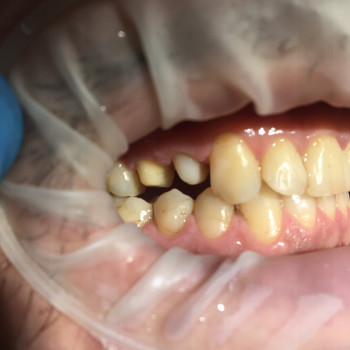 Михайло Скалій, Ивано-Франковск Фото - 8