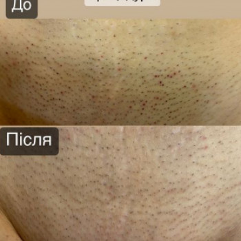 Вита , Днепр Фото - 5