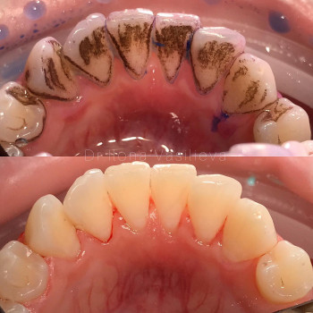 Володимир Вечірко, Винница Фото - 5