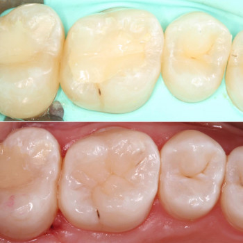 Володимир Вечірко, Винница Фото - 6